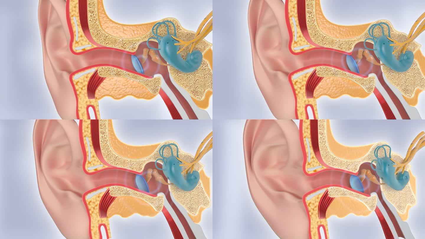AE耳膜 耳鼓 耳病 听力  耳聋 耳鸣