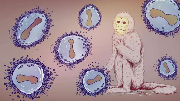 猴痘病毒猴痘疫情传播风险-版本3