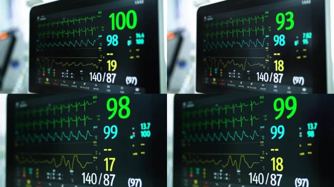 心电监护仪 救援急救 心电图