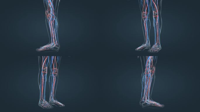 静脉曲张 下肢血管 腿血管 三维动画