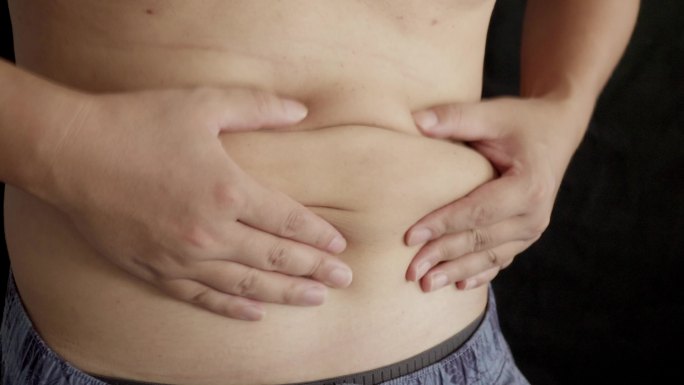 中年人大肚男肥胖脂肪啤酒肚胃下垂