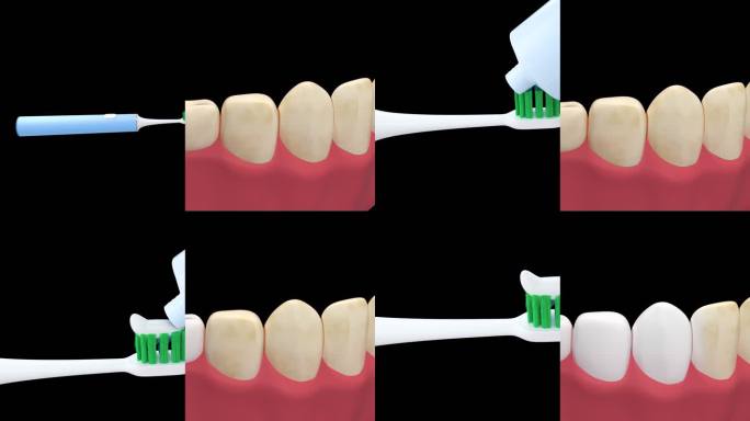 牙齿护理 挤牙膏与牙齿美白