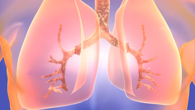 肺部病变由于支气管长期反复的感染