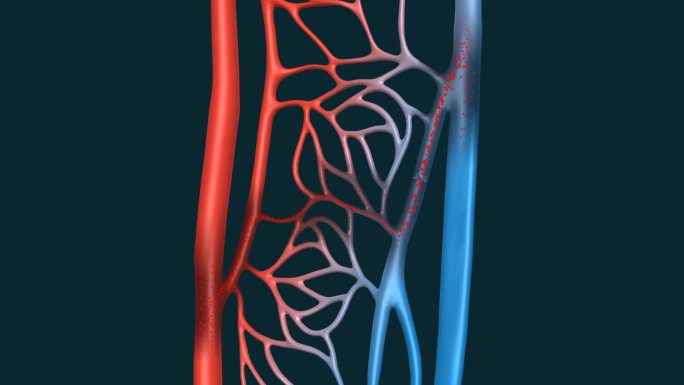 医学动画 血管动画 3D血管 三维血管
