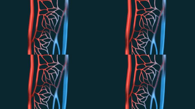 医学动画 血管动画 3D血管 三维血管