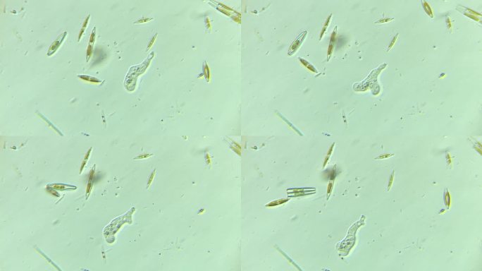 显微镜下的微观世界微生物 硅藻