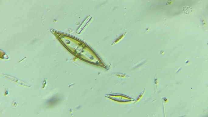 显微镜下的微观世界微生物 硅藻