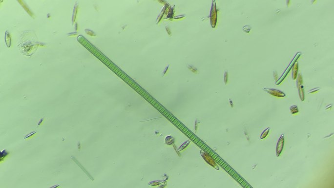 显微镜下的微观世界 颤藻