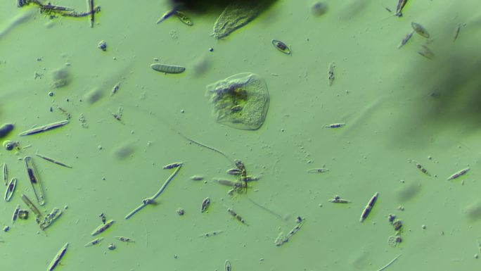 显微镜下的微观世界微生物 硅藻与变形虫