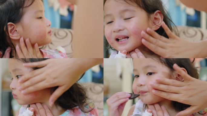 特写婴儿脸有皮疹通常出现在蹒跚学步的女孩身上。过敏：儿童脸颊发红