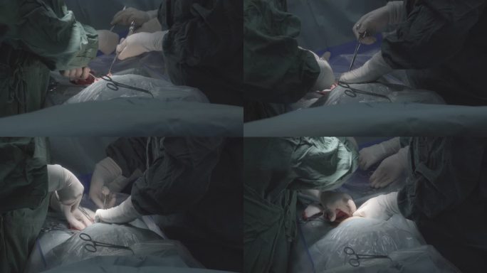 log原始，手术，医疗，破腹产，医院