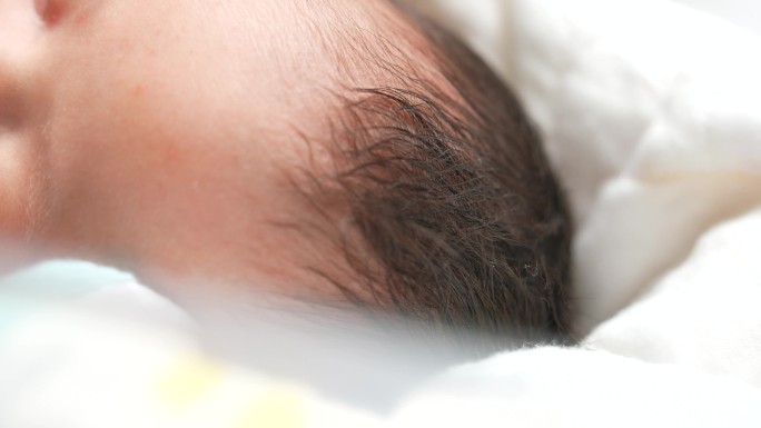 新生儿头发少胎毛