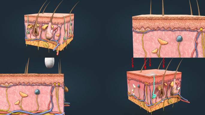 皮肤的层次皮肤冷热感觉 皮神经 三维动画