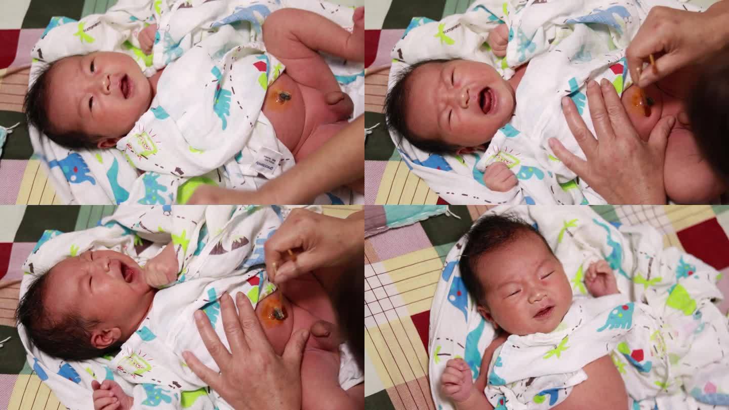 1个月婴儿肚脐正常图片（宝宝的肚脐很娇弱）-幼儿百科-魔术铺