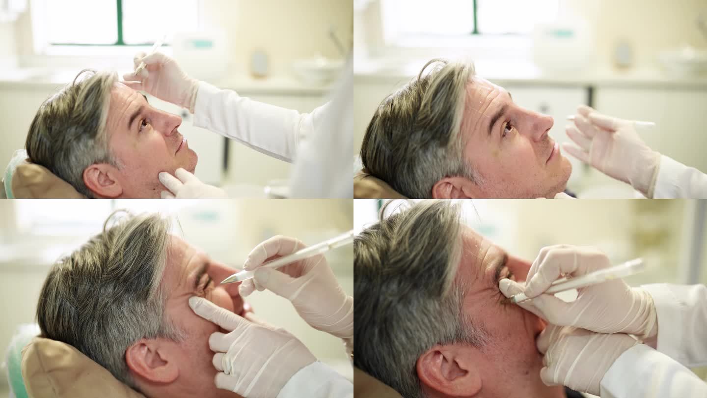 美容师在成熟男性患者脸上做肉毒杆菌注射标记
