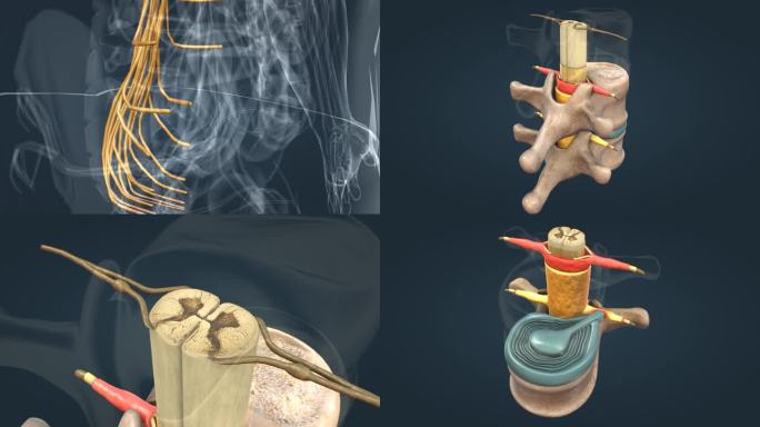 神经系统 椎间盘突出 脊髓 三维动画