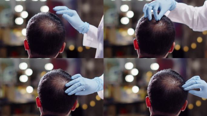 美容医生用注射器将治疗血清维生素注射到头发脱落区域，短发