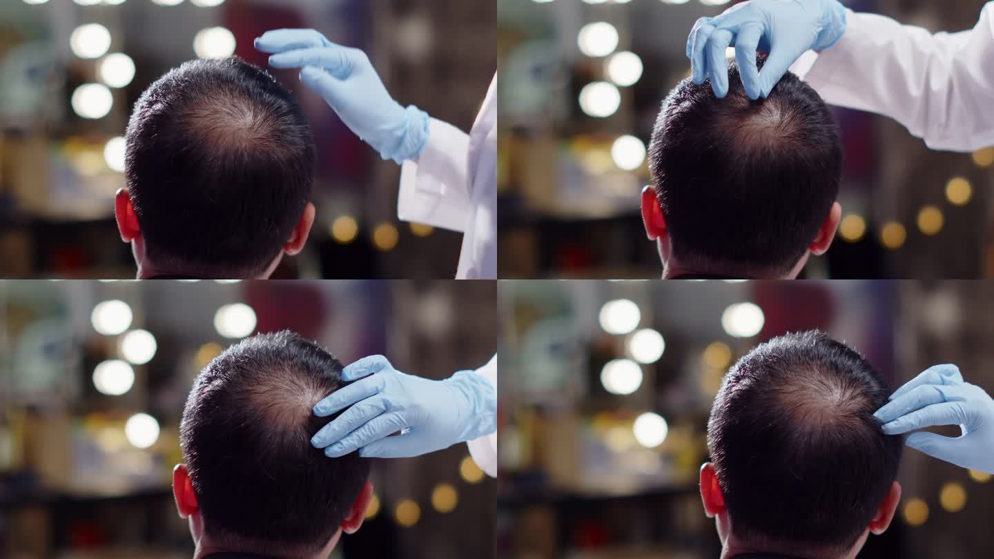 美容医生用注射器将治疗血清维生素注射到头发脱落区域，短发