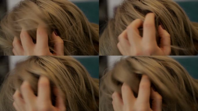 皮脂溢和头皮屑问题-b滚动超慢动作