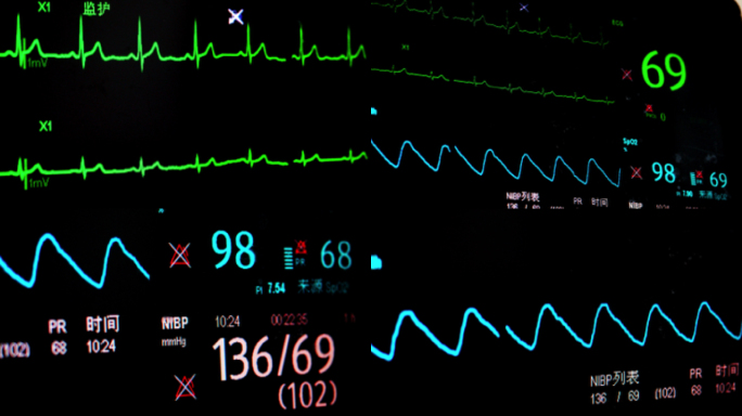 心率监测仪重症监护心率仪健康监测