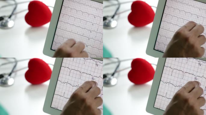 医生使用带心率图的数字平板电脑