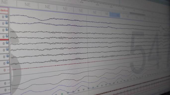 显示脑电波的计算机监视器