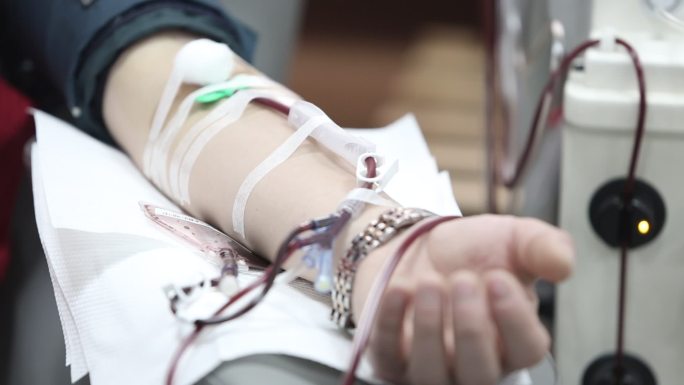 献血志愿者捐献造血干细胞血液流动透析手