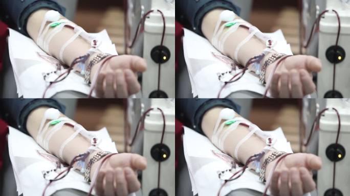 献血志愿者捐献造血干细胞血液流动透析手