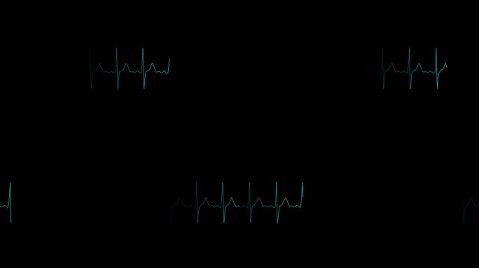 4K心电图心跳视频素材
