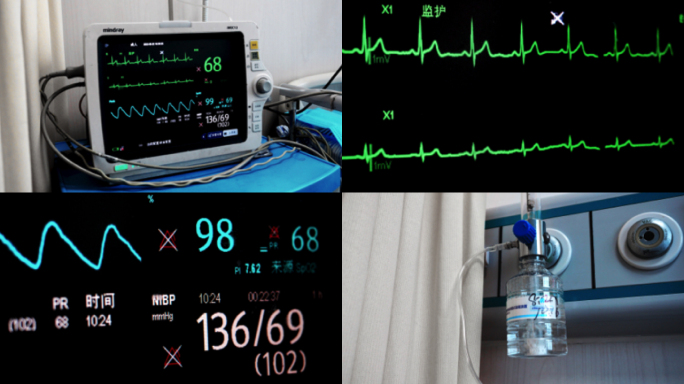 心率检测仪健康监测ICU病房生病住院患者