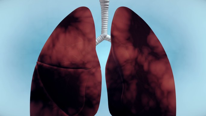 肺部吸烟问题-4K分辨率
