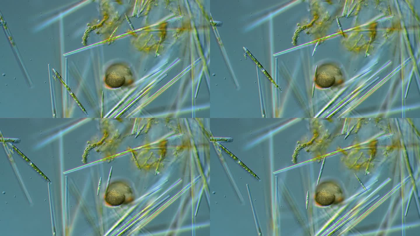 硅藻-微生物显微观察显微摄影微生物