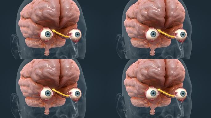 大脑 人体 器官 医学 视神经 强光