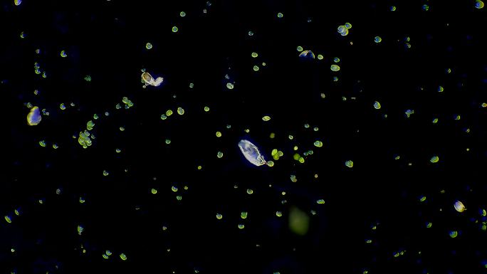 微生物-轮虫，暗场显微镜