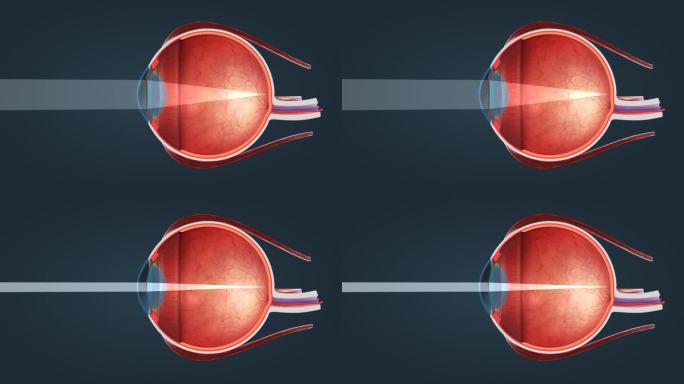 眼球 眼珠 视网膜 视神经 医学3D人体