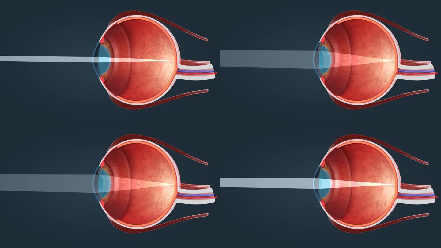 人眼 眼球 眼睛 视觉系统 视网膜