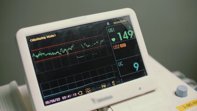 生命体征监测器医疗设备心电图检测