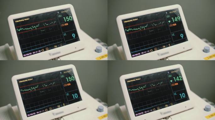 生命体征监测器医疗设备心电图检测