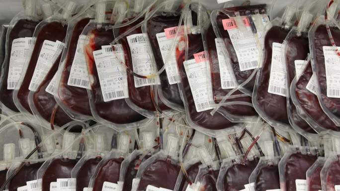 医院里为病人捐献的一袋袋血液。干得好。献血对身体的好处。捐献者血液
