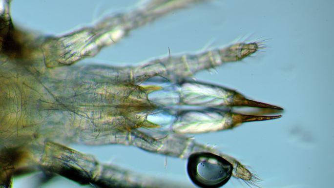显微镜下的螨虫螨虫生长显微镜的世界