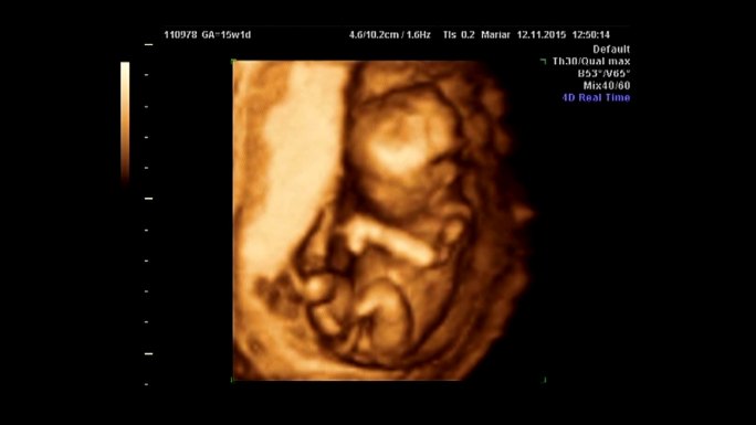 婴儿超声波怀孕孕检B超检查小生命发育情况