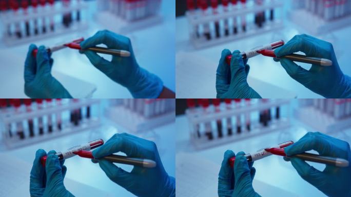 一名实验室助理在血样试管上做标记的特写镜头，画面中只有戴着防护手套的手