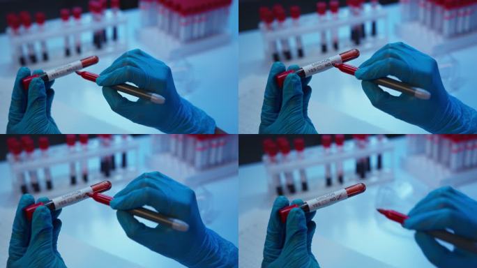 一名实验室助理在血样试管上标记阴性结果的特写镜头，框架中只有戴着防护手套的手