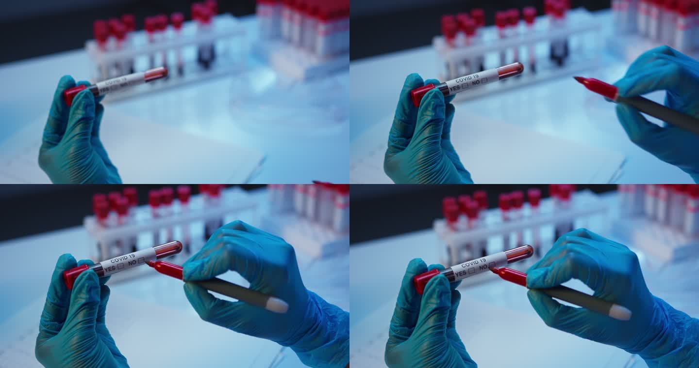 放大实验室助理的手在血样试管上标记阴性结果
