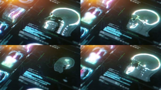 头骨和大脑MRI扫描。MRI实验室设备。