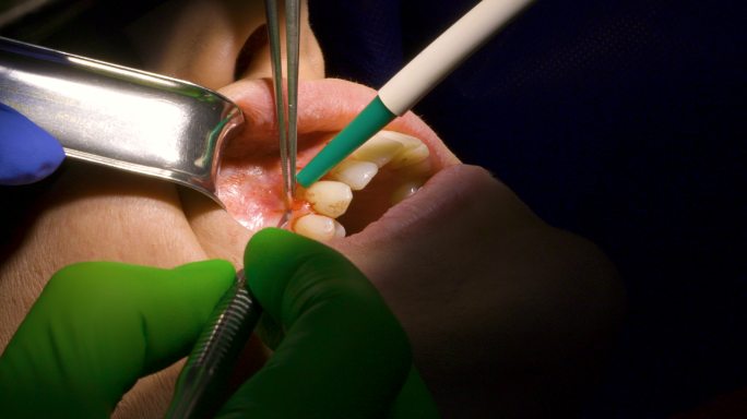 牙科介入手术医学检查患者看牙医疗设施