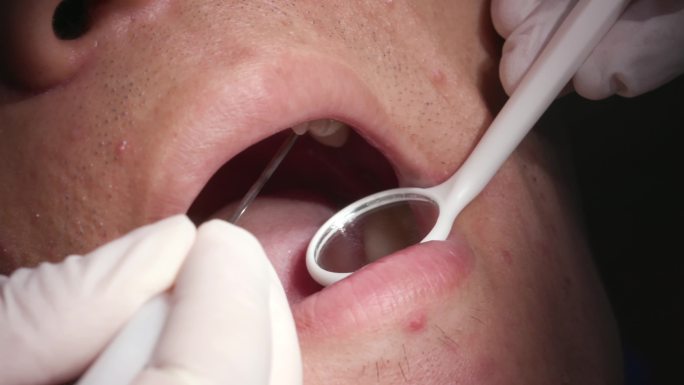 4K牙科诊所看牙牙医工作牙科手术