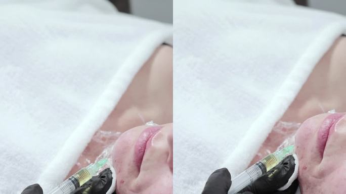 美容师在一位妇女的下巴注射药物，以使皮肤年轻化。