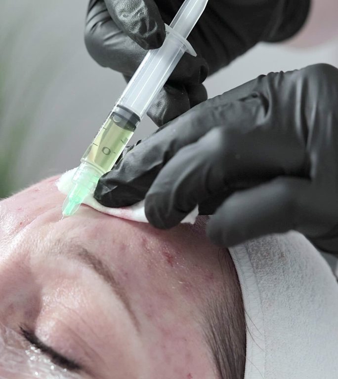 美容师在一位妇女的前额注射药物，以使皮肤年轻化。