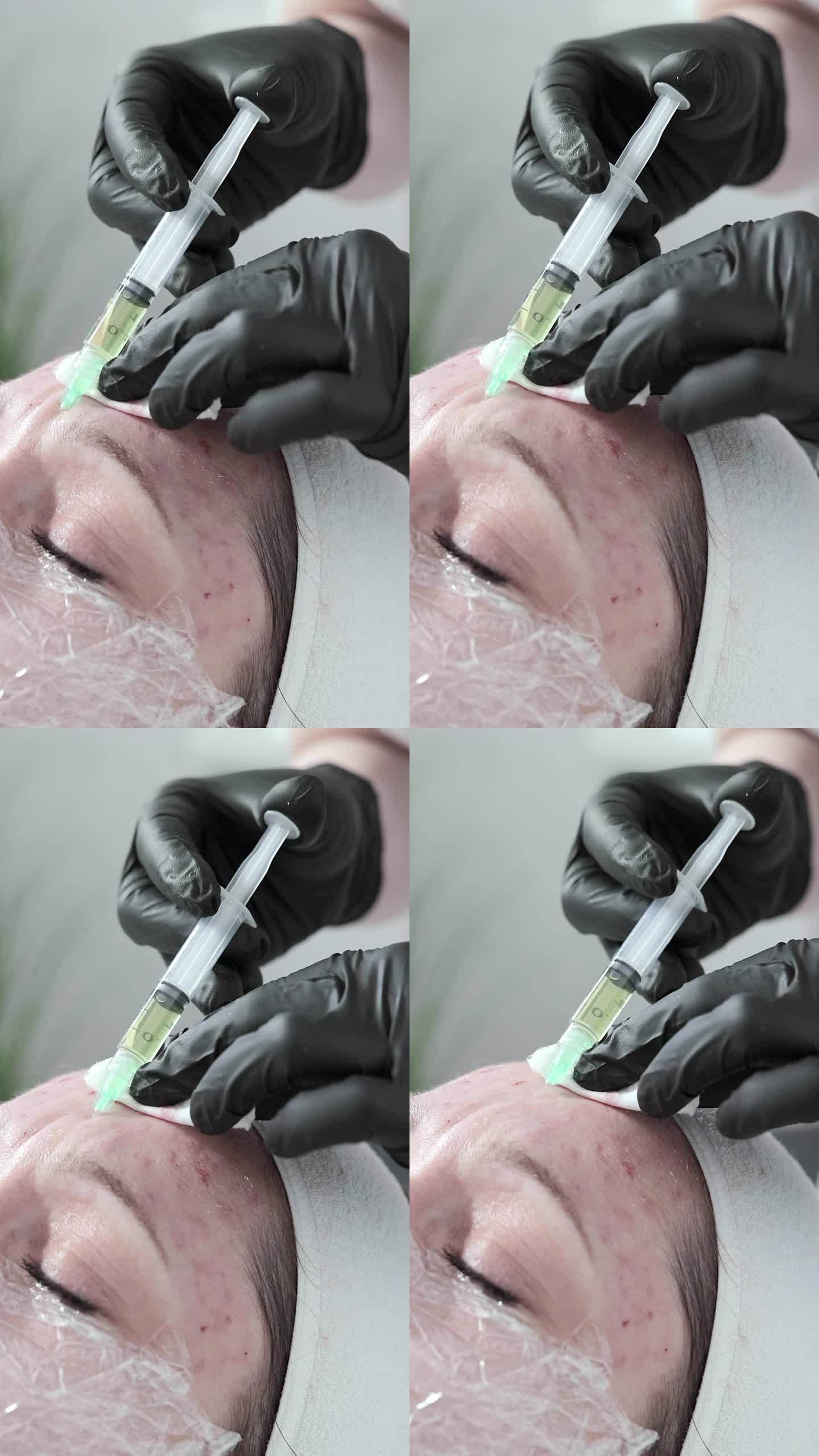 美容师在一位妇女的前额注射药物，以使皮肤年轻化。